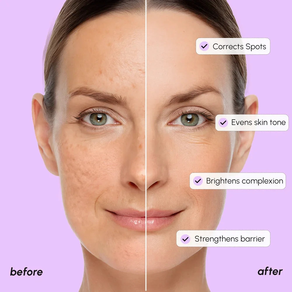 Dark Spot Corrector